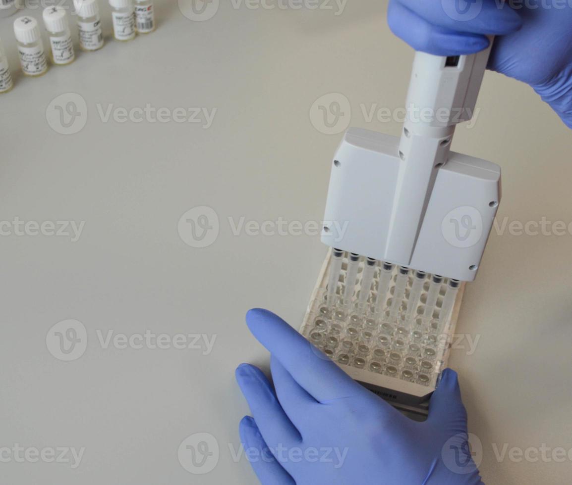 a doctor in blue, disposable, nitrile gloves performs a laboratory analysis by an immunoassay method. a blood test from a vein. portable pipette for handling liquids photo
