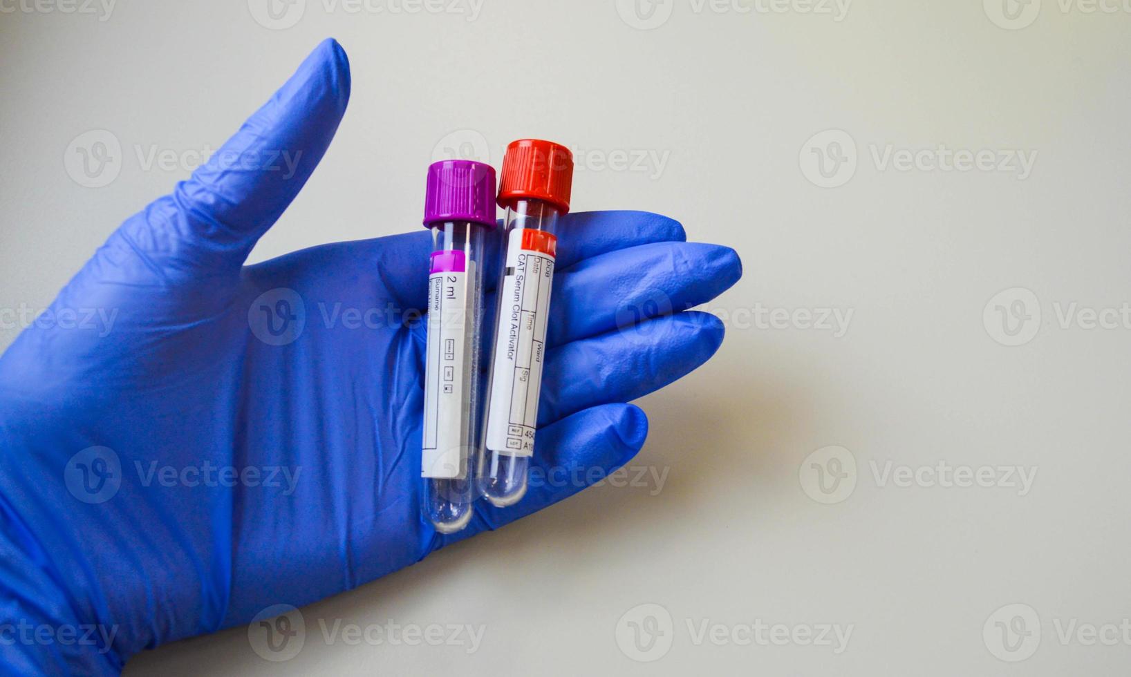 una mano con guantes azules sostiene un tubo de ensayo con un tapón azul. copiar un espacio. hay espacio para el texto. Equipo medico foto