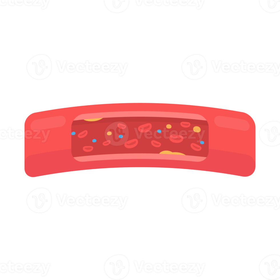 coronary arteries with accumulated fat in the body png