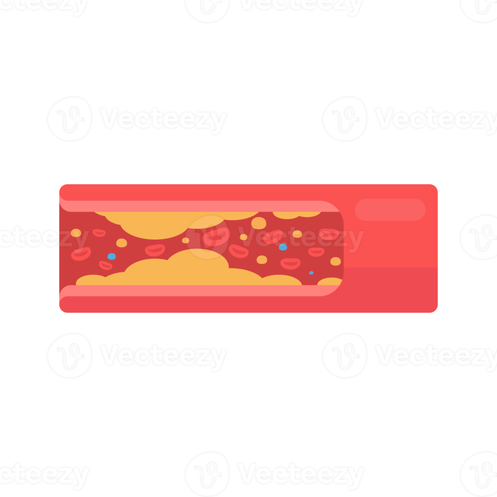 coronary arteries with accumulated fat in the body png