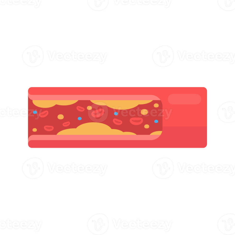 coronary arteries with accumulated fat in the body png