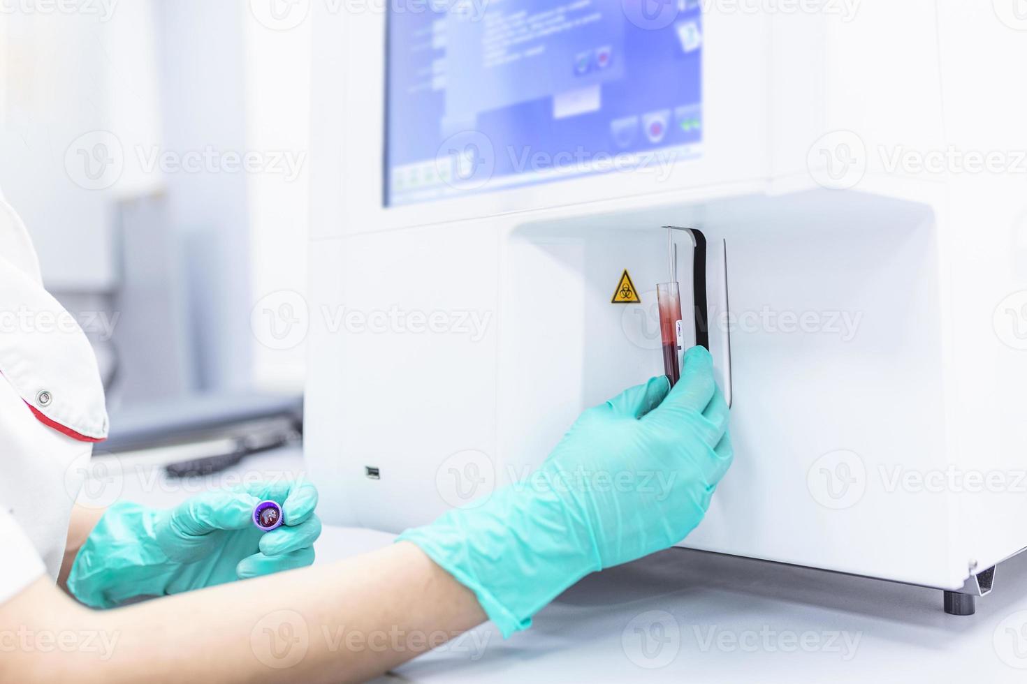 Lab technician holding blood in EDTA tube for test complete Blood Count testing hematology laboratory. Scientific medical test with automated hematology analysis. photo