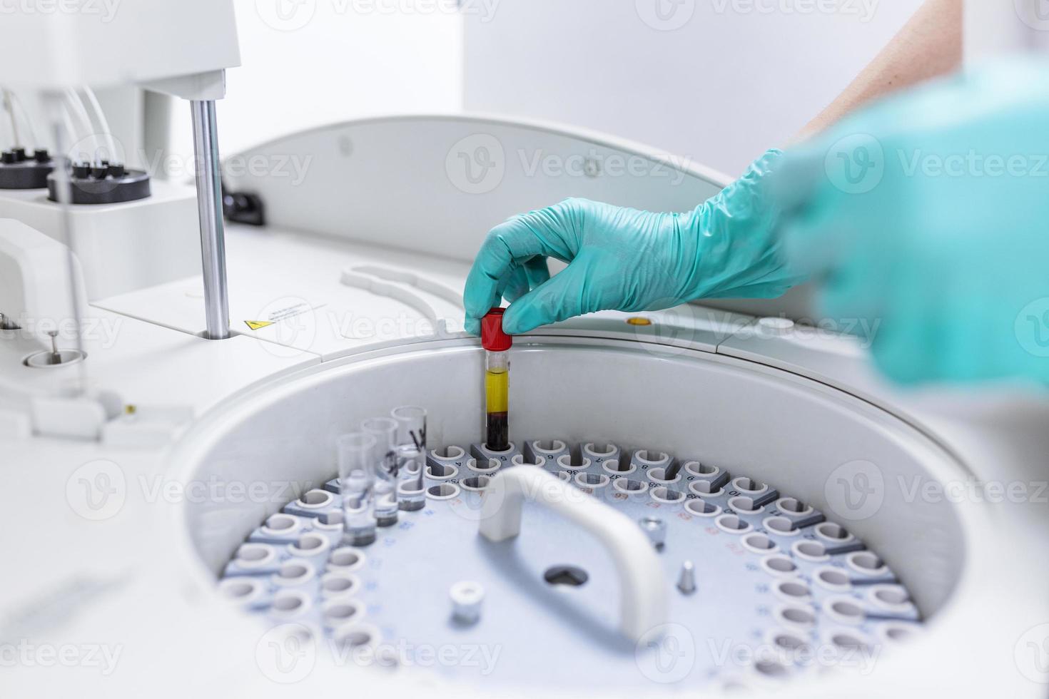 hands of female researcher loading samples in centrifuge in laboratory photo