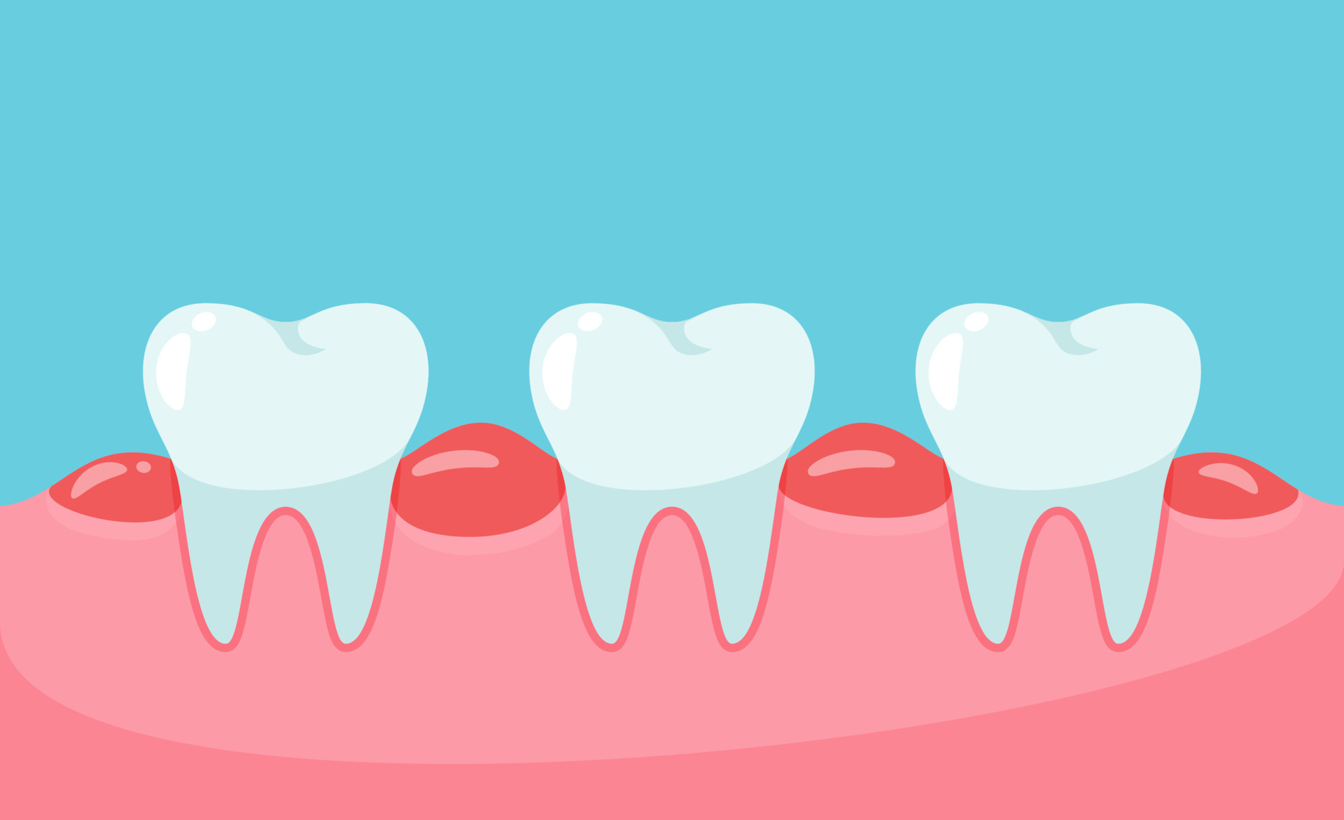 Vector Swollen Teeth Unhealthy Gums 15159463 Vector Art At Vecteezy