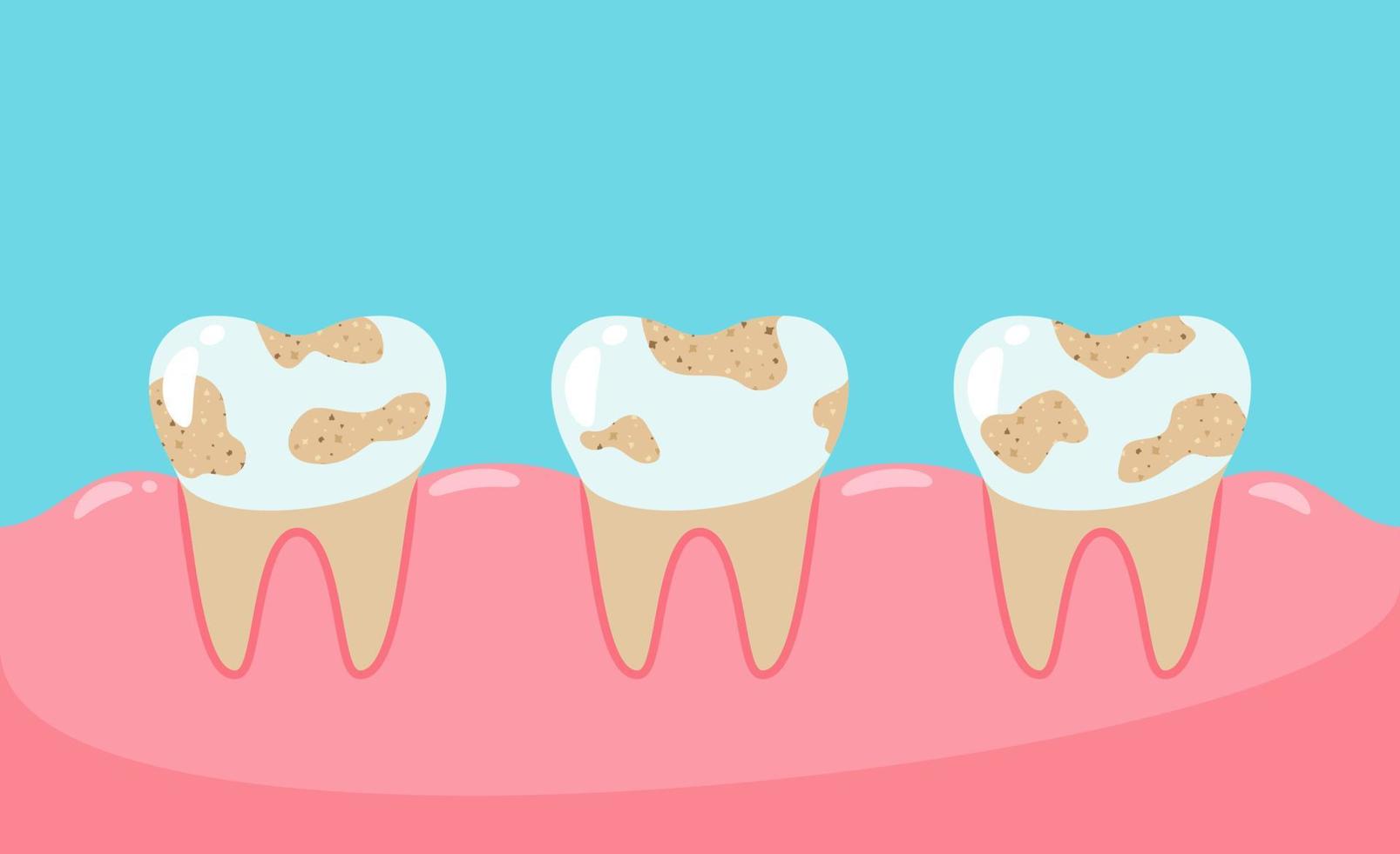 los dientes sucios no se mantienen. dientes poco saludables. vector