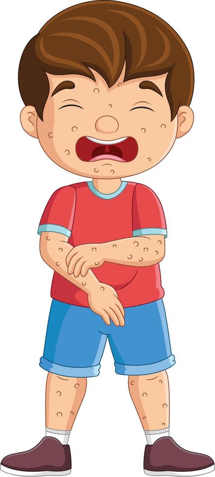 Cartoon sad little boy with chickenpox vector