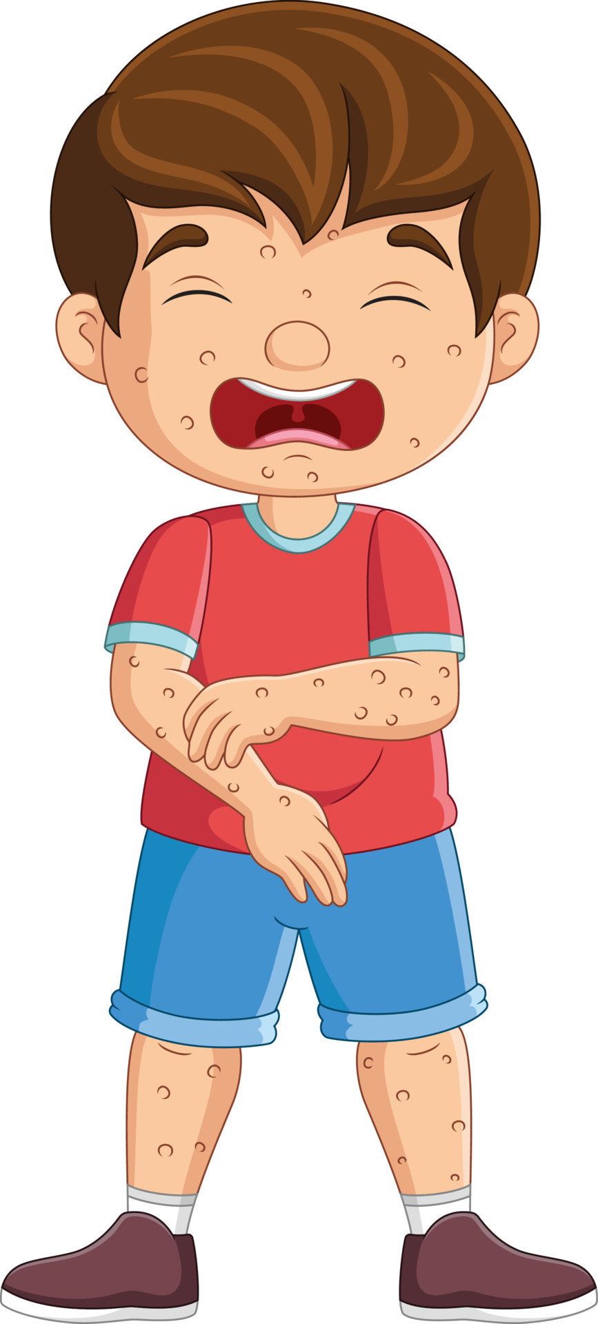Cartoon sad little boy with chickenpox 15219814 Vector Art at Vecteezy