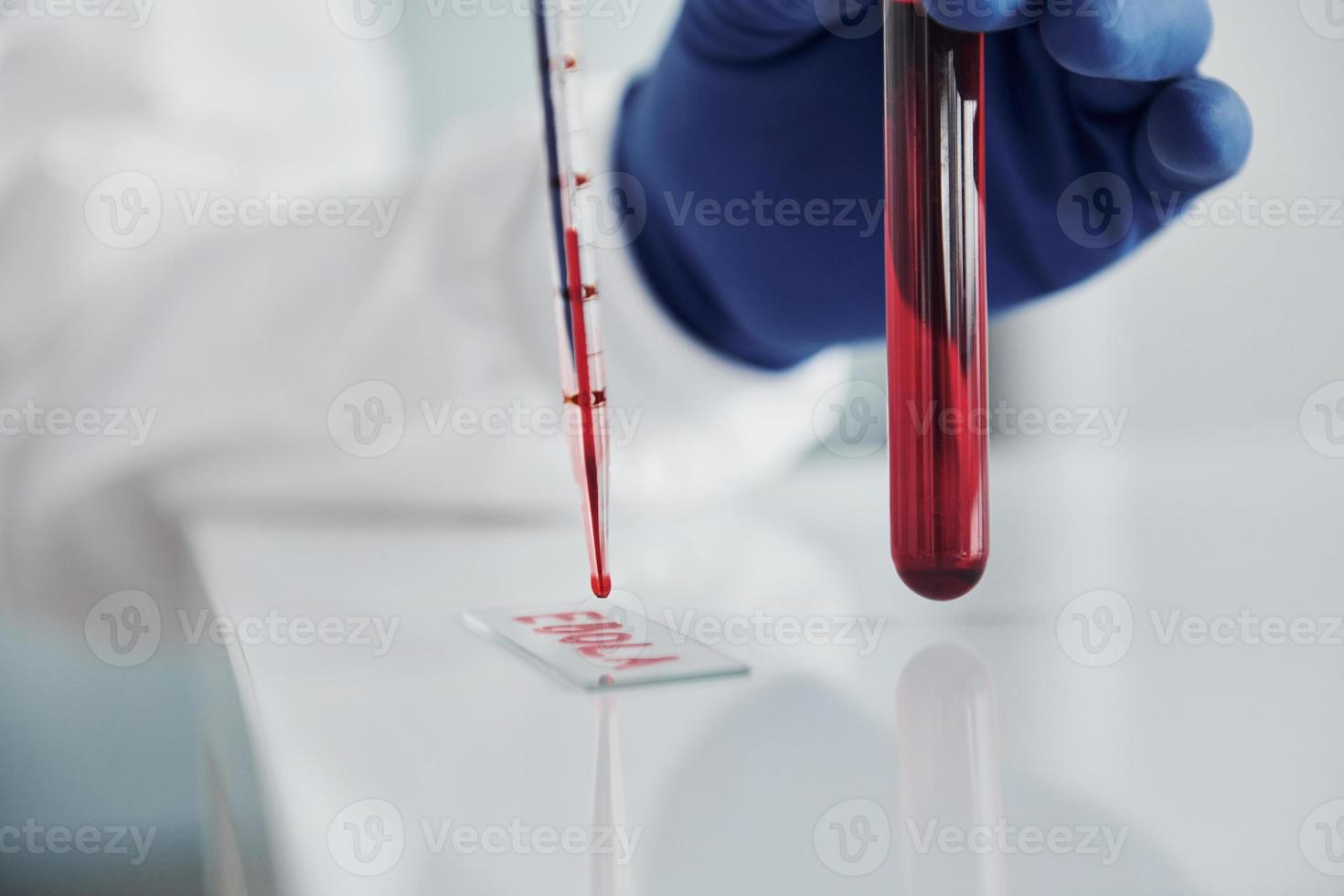 Close up view of doctor in lab coat that works with test tube with blood inside of it photo