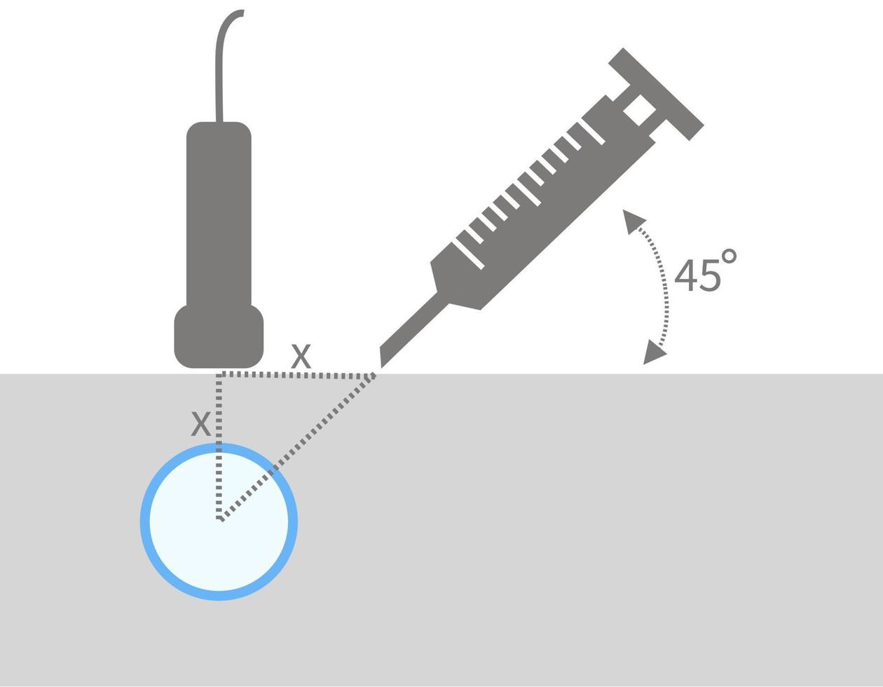 animación del método de inserción de un catéter venoso central guiada por ecografía vector