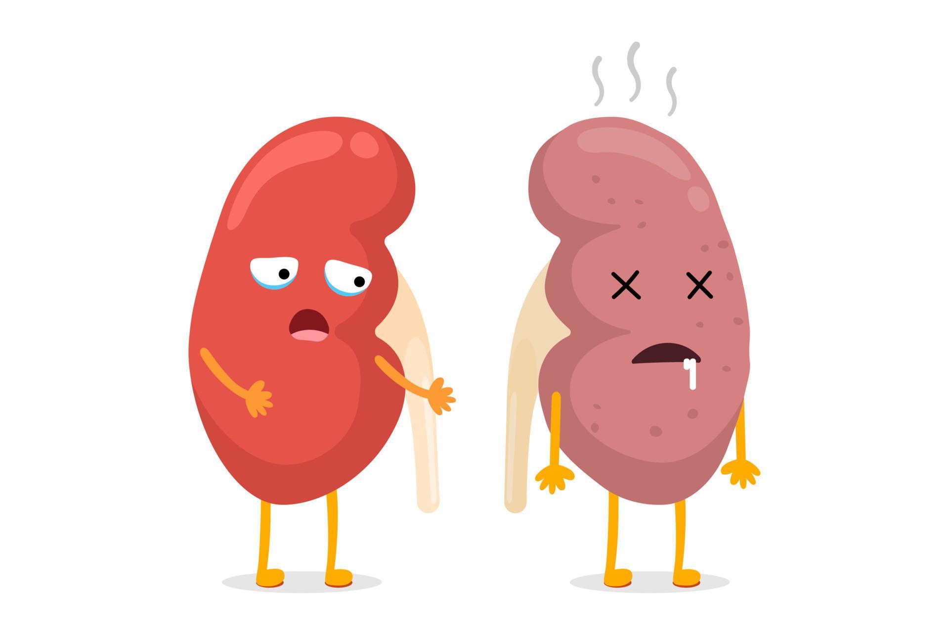 Kidneys characters healthy and unhealthy comparison. Human kidney good
