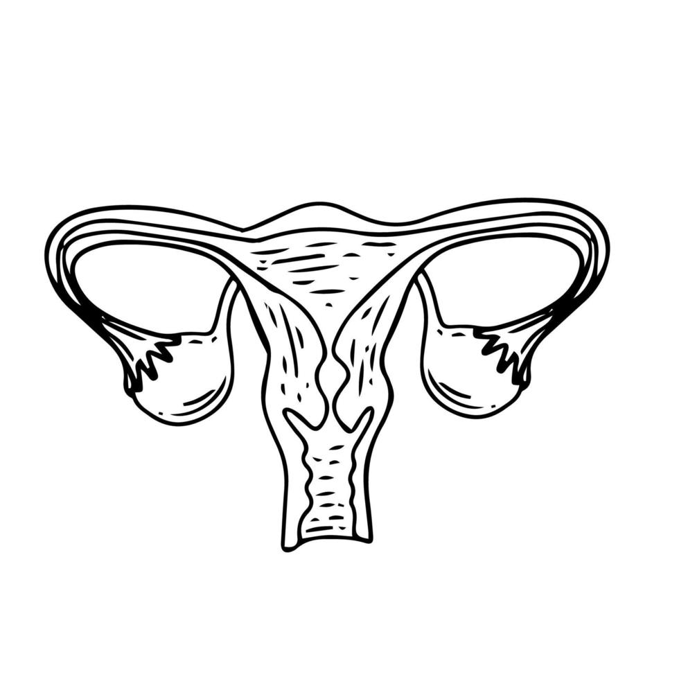 salud de la mujer - infografía floral del síndrome de ovario poliquístico. esquema amigable para el paciente de pcos, quiste multifolicular. problemas ginecológicos - diagrama médico neutral útero y apéndices uterinos, vector