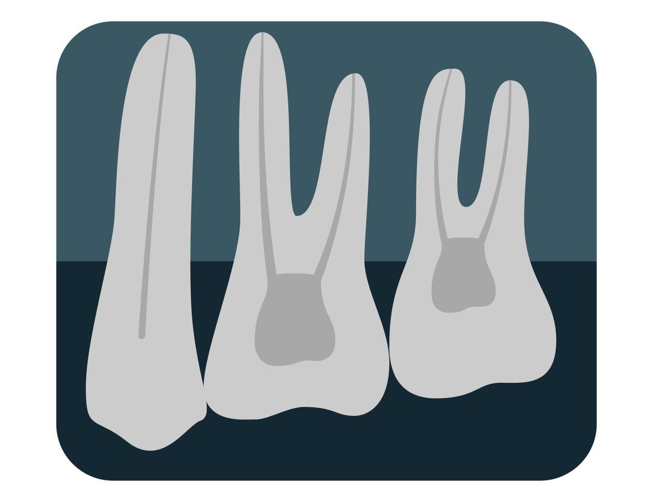 X-ray of human teeth. Three healthy molars on an x-ray. Vector illustration.