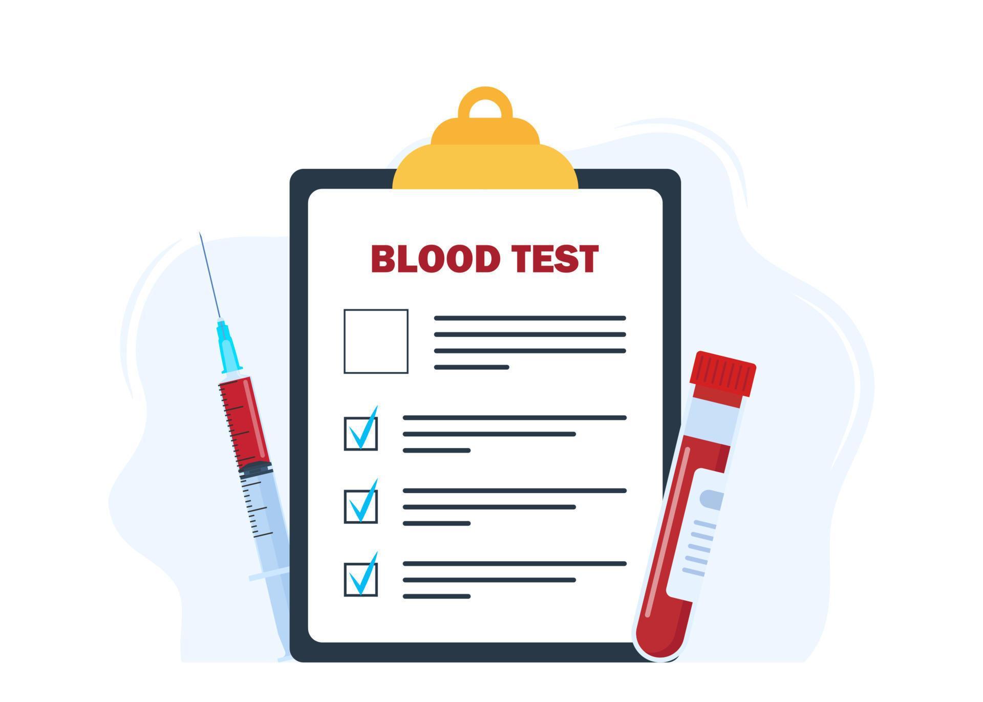 Medical blood test concept. Chemical laboratory analysis, medical