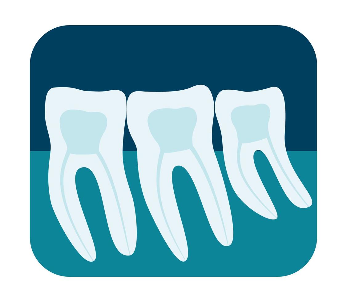 X-ray of human teeth. Three healthy molars on an x-ray. Vector illustration.