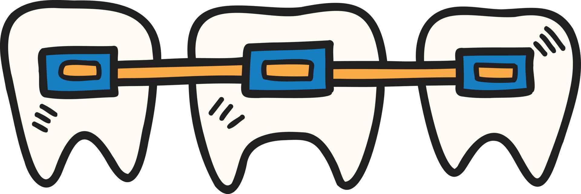Hand Drawn braces and teeth illustration vector
