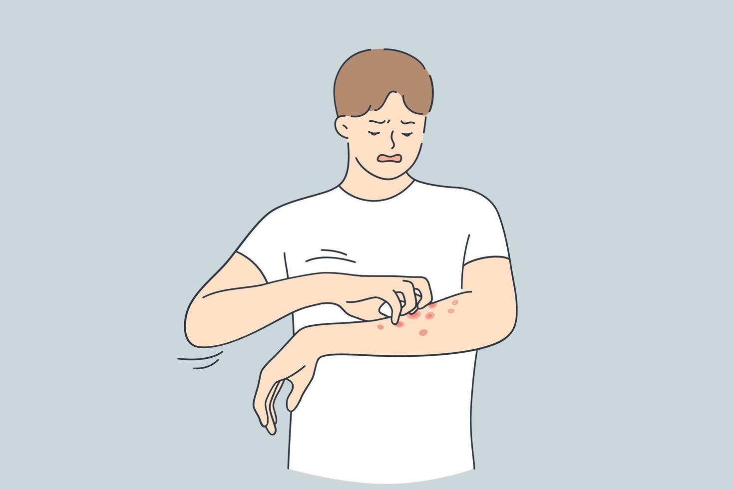 alergia cutánea, dermatitis, concepto de eczema. joven molesto con camiseta blanca rascándose la picazón en el brazo sintiéndose infeliz e incómoda ilustración vectorial vector