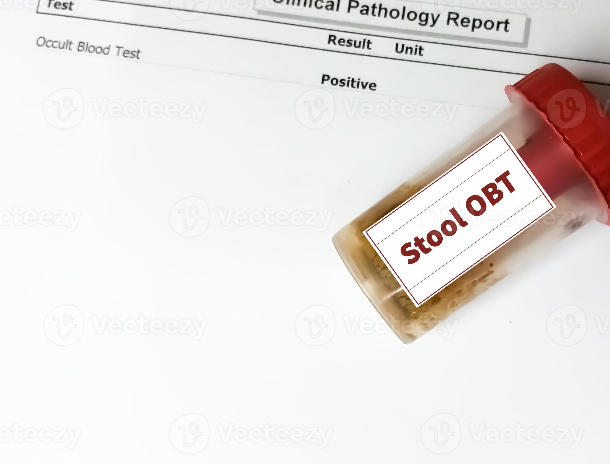 Stool sample container for occult blood test or OBT with abnormal