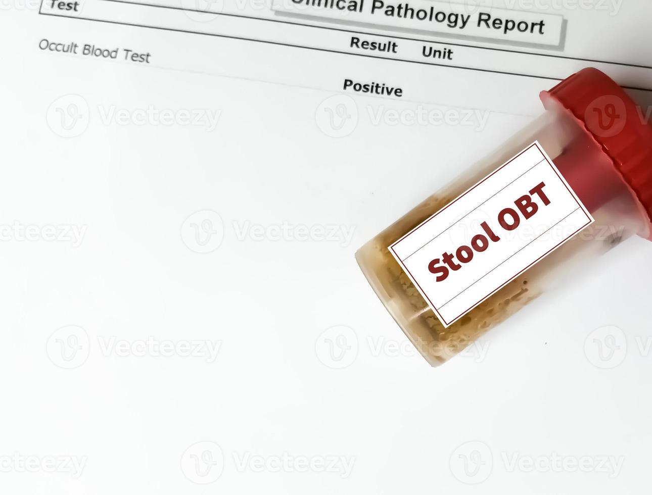 Stool sample container for occult blood test or OBT with abnormal patient's report. photo
