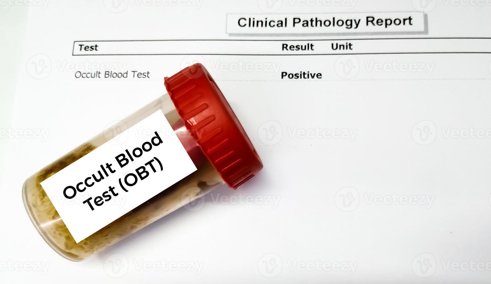 Stool sample container for occult blood test or OBT with abnormal patient's report. photo