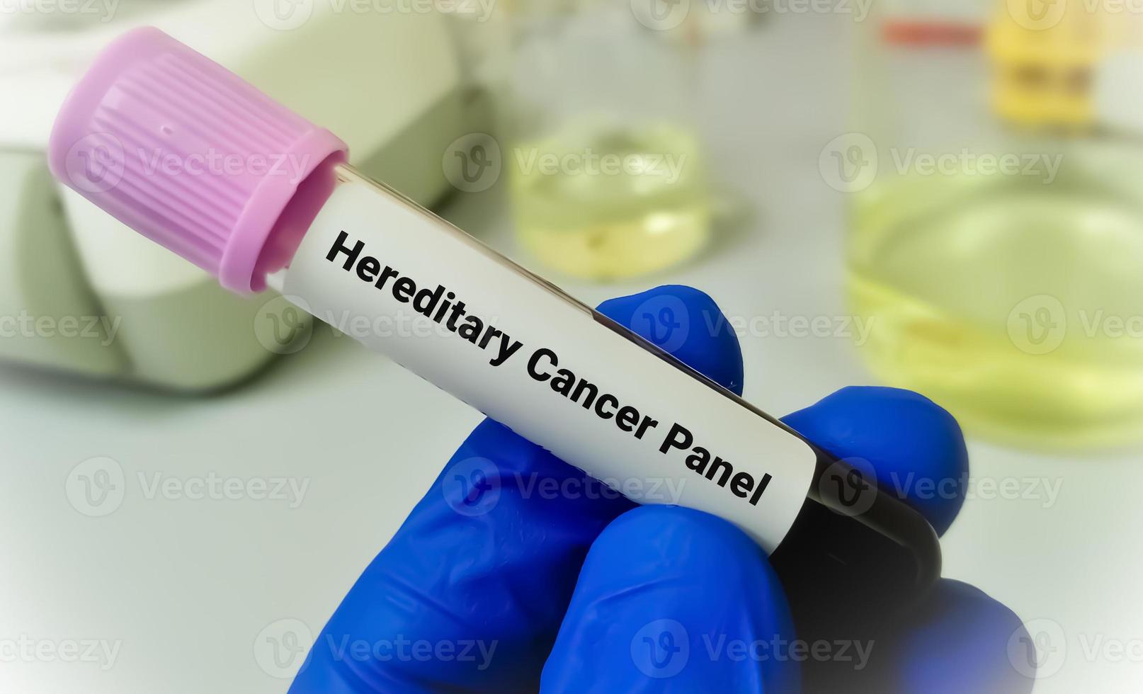 Blood sample for hereditary cancer panel test, including the detection of 47 genes associated with hereditary breast, ovarian, uterine, colorectal, melanoma, and prostate cancer. photo