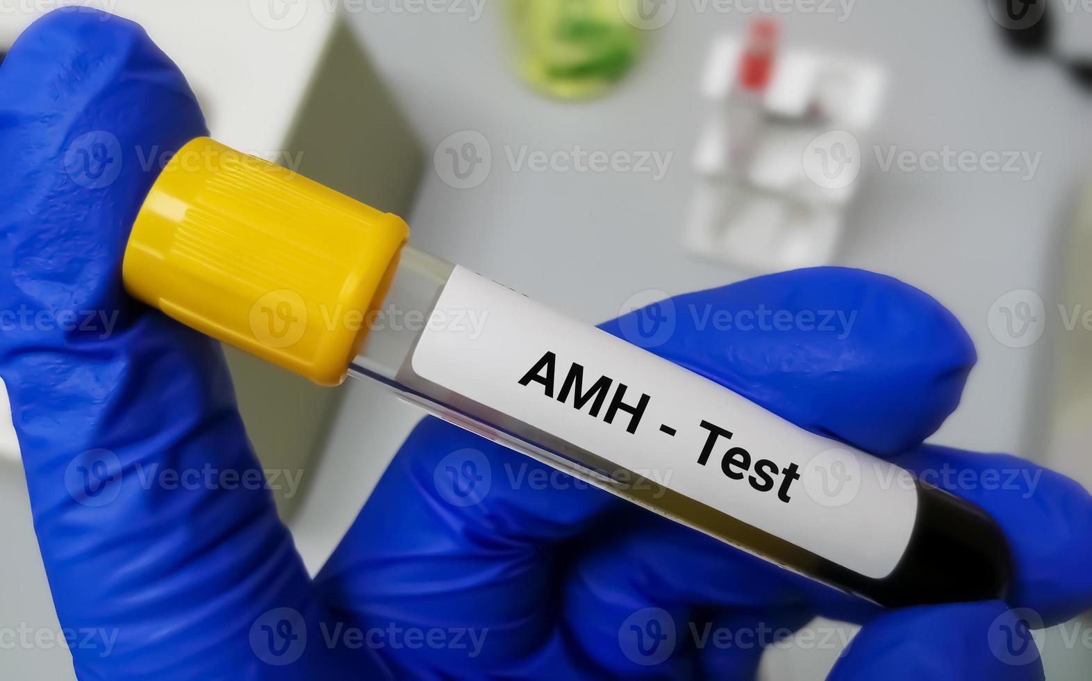 Blood sample tube for AMH or anti-mullerian hormone test, evaluate of ovarian function and fertility in woman photo