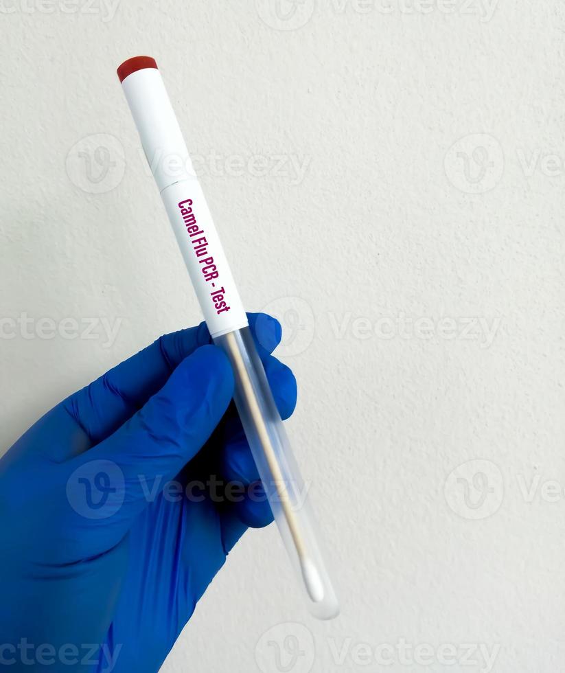 Nasal Swab for Camel flu or Middle East respiratory syndrome test photo