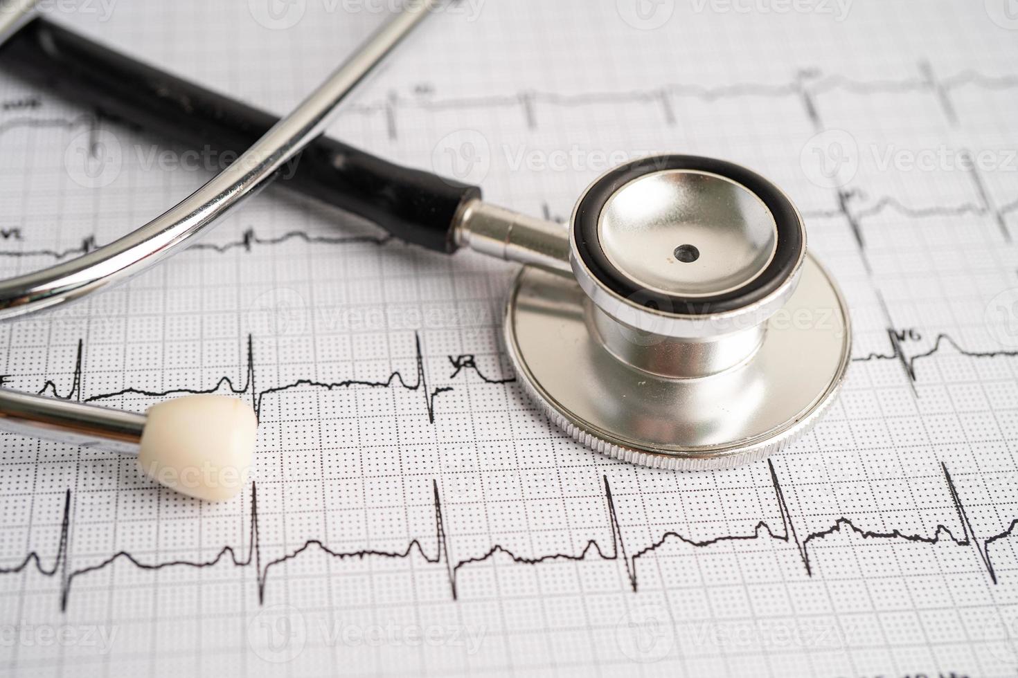 Stethoscope on electrocardiogram ECG, heart wave, heart attack, cardiogram report. photo