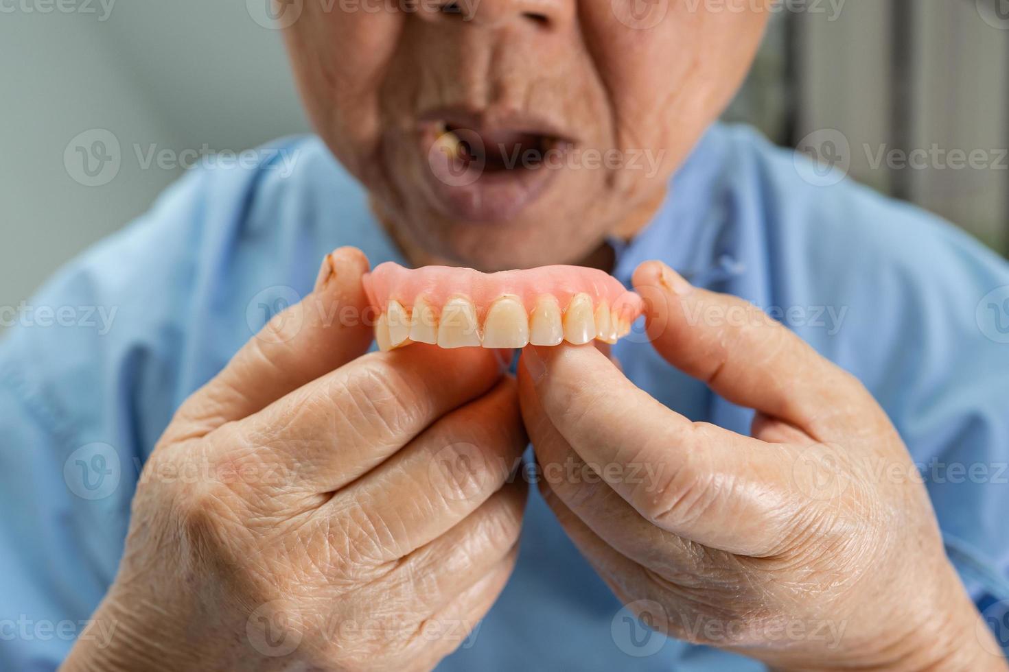 Asian senior or elderly old woman patient holding to use denture in nursing hospital ward, healthy strong medical concept photo