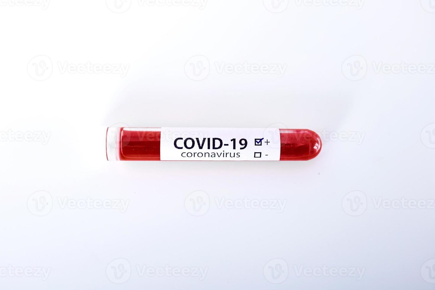 Positive COVID-19 test and laboratory sample of blood testing for diagnosis new Corona virus infection novel corona virus disease 2019 with hospital background. Pandemic infectious concept photo