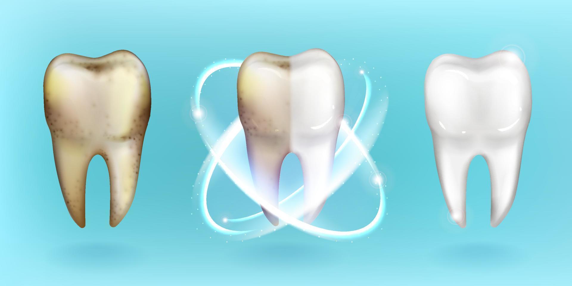 diente limpio y sucio, blanqueamiento o limpieza de dientes vector