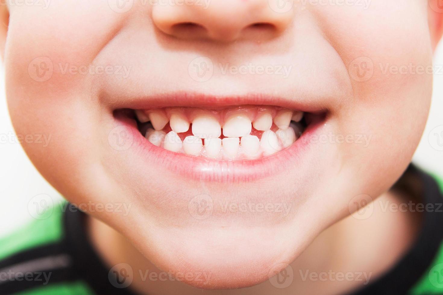 baby smile close. child teeth on a white isolated background. photo