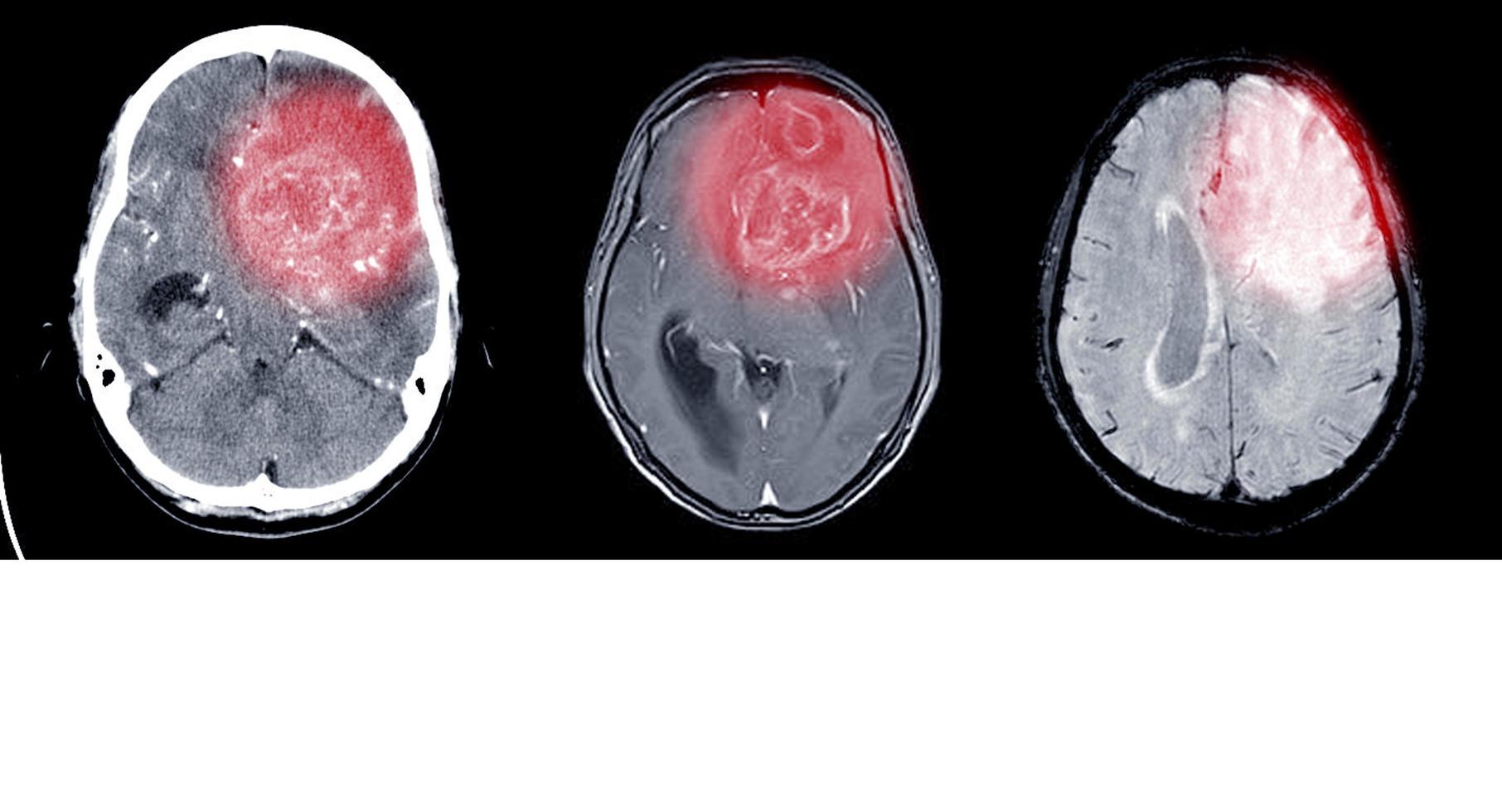 CT and MRI Brain scan. photo