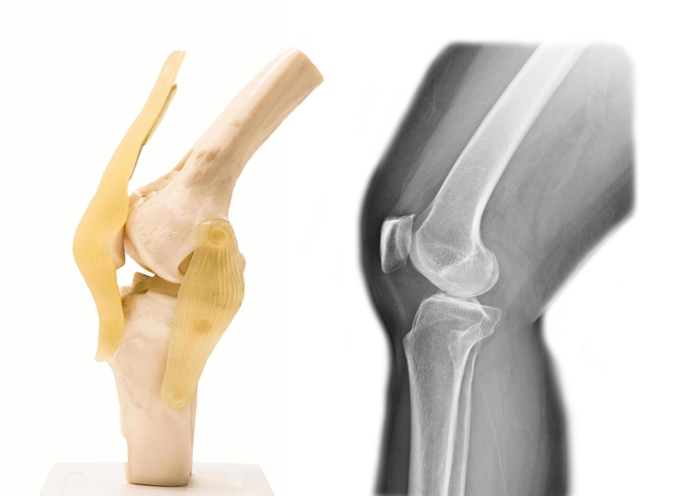 modelo de articulación de rodilla humana artificial en medicina foto
