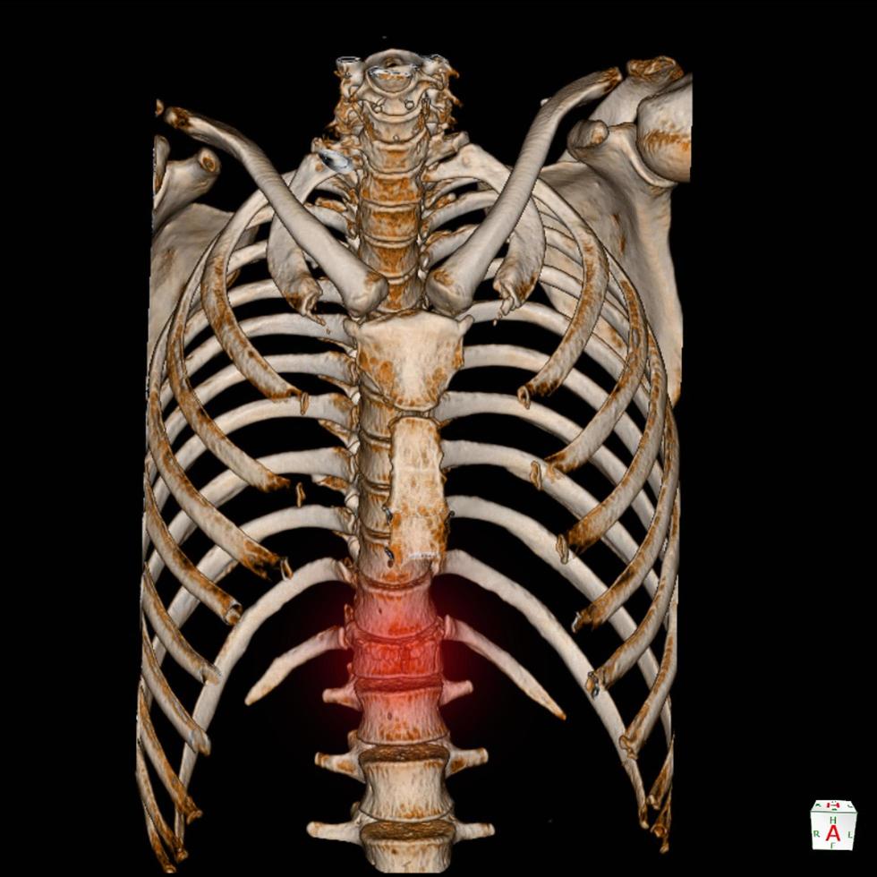 CT Scan 3D render Human Skeleton System Thoracic Skeleton Anatomy . photo