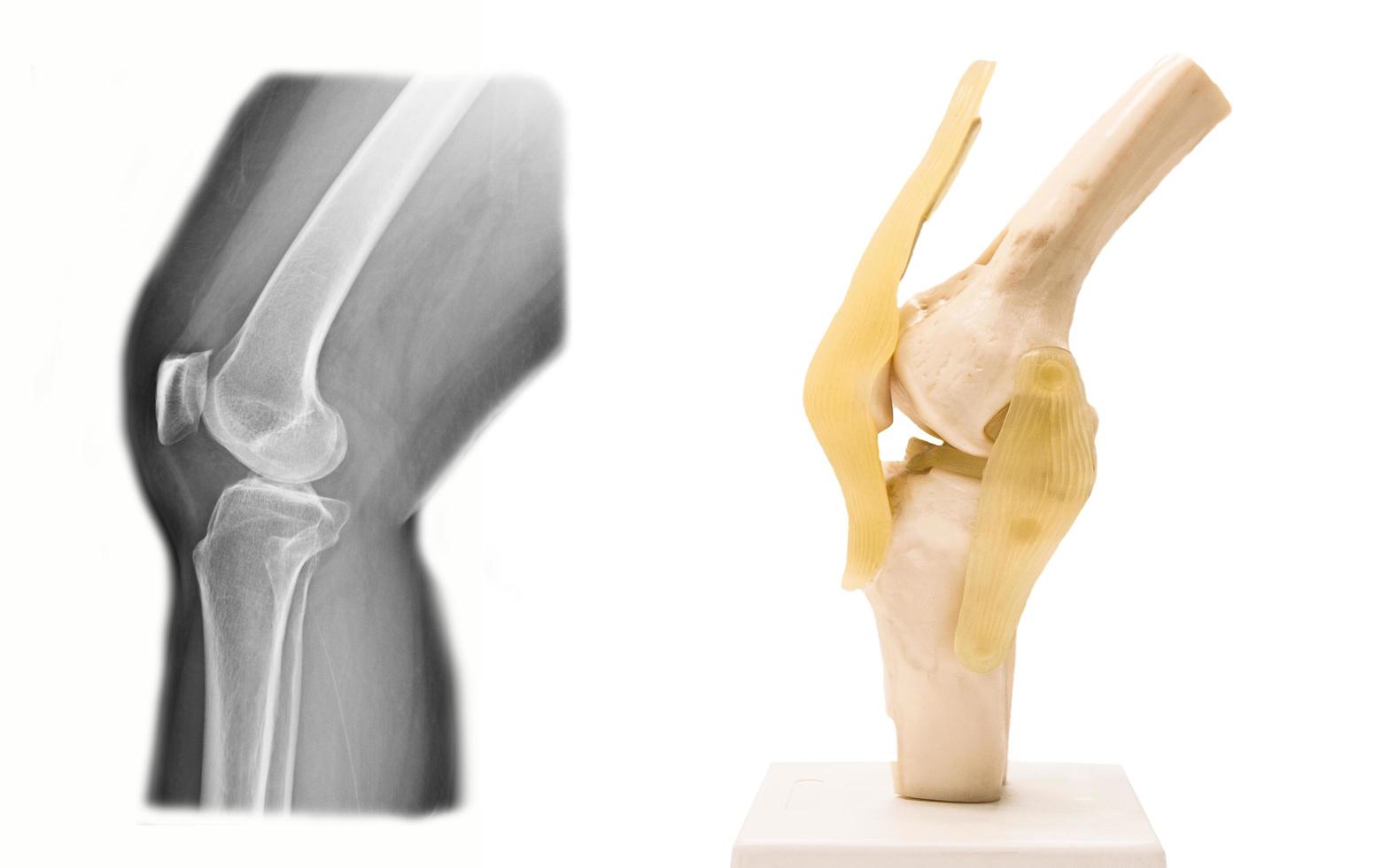 modelo de articulación de rodilla humana artificial en medicina foto