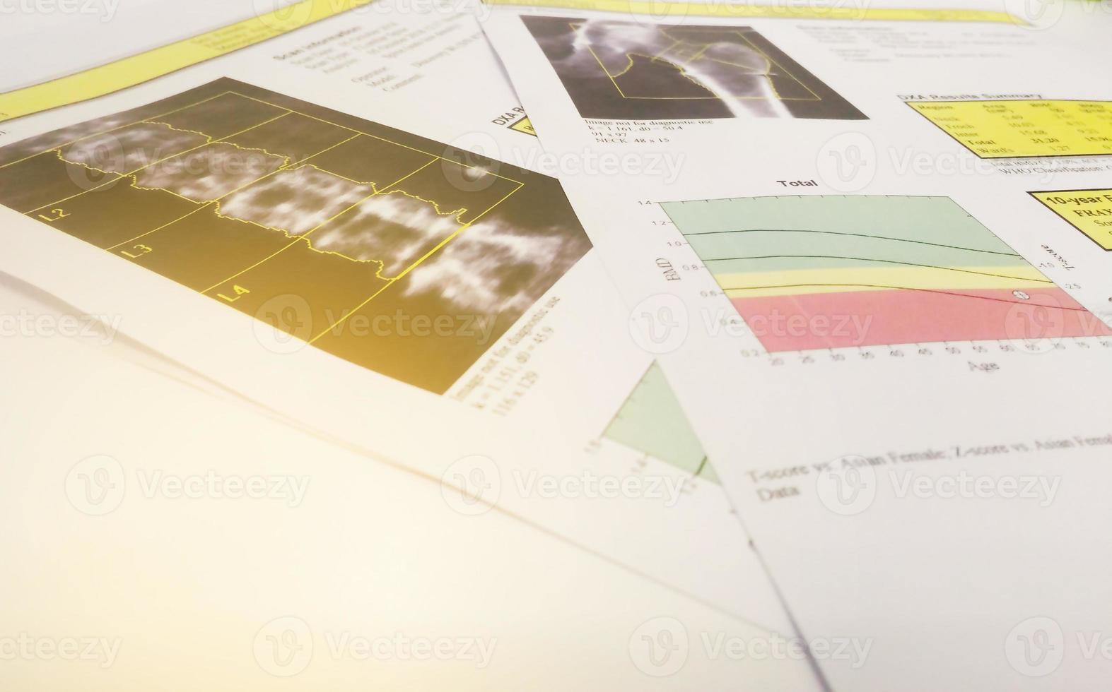 Close up Bone density report photo