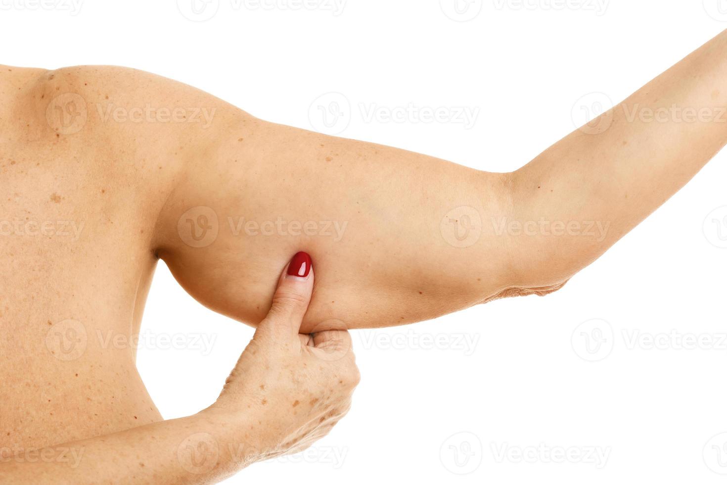 Mujer adulta obesa mostrando el brazo sobre fondo blanco. foto