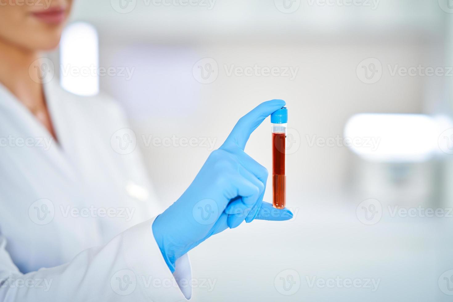 Woman holding test tube with blood and mixing machine photo