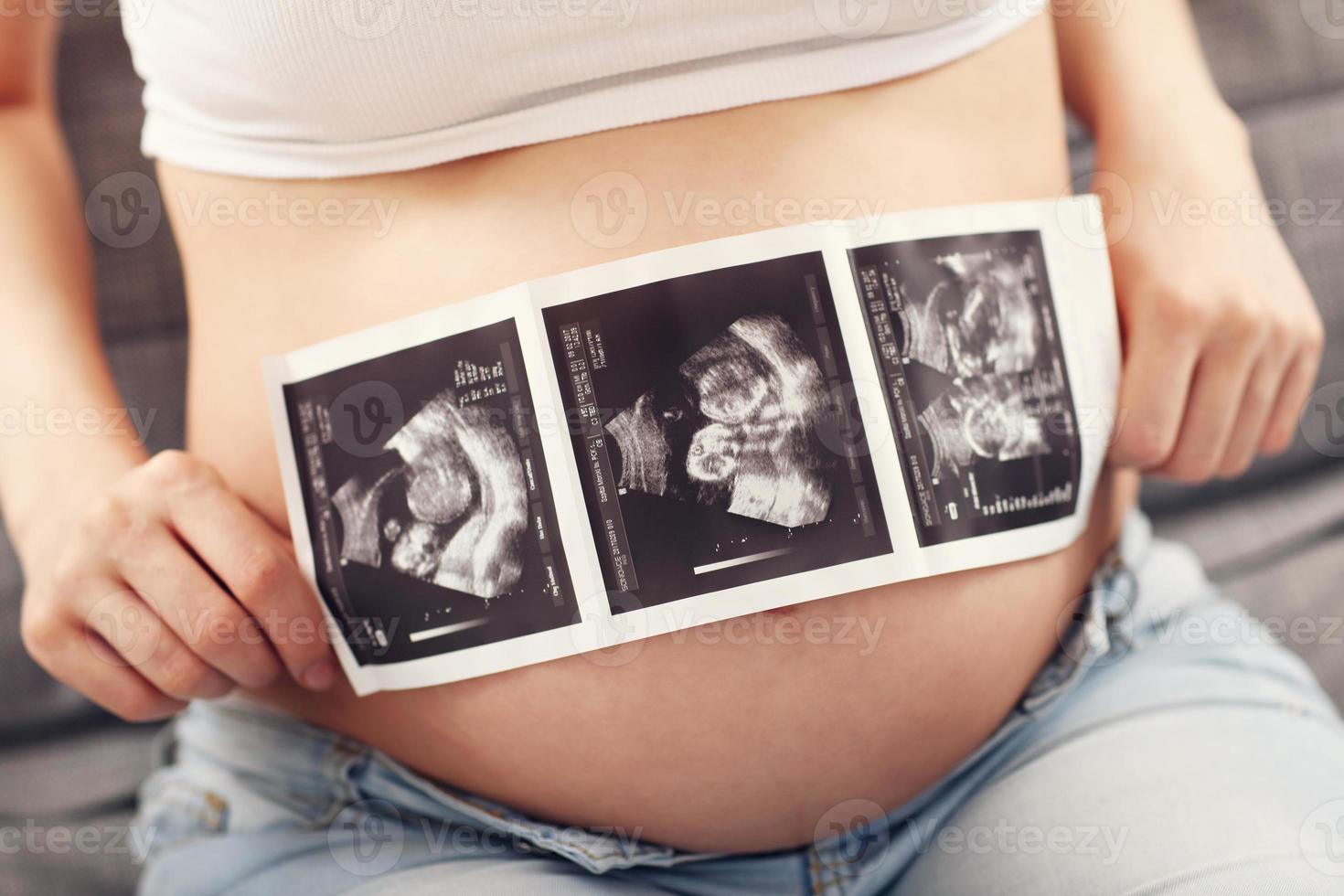 Cerca de la mujer embarazada con ecografía en su barriga foto