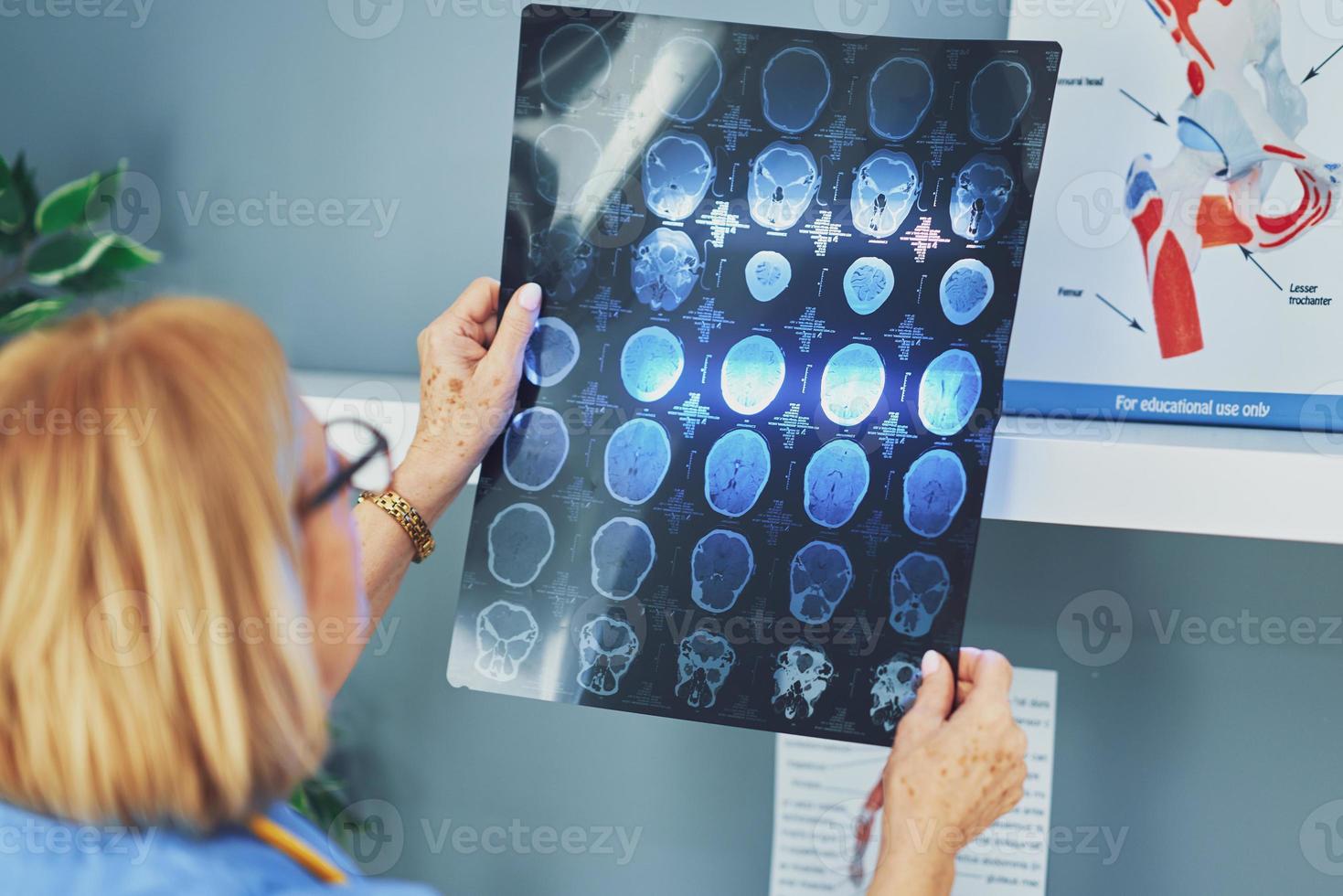 Woman doctor checking diagnosis on film image photo