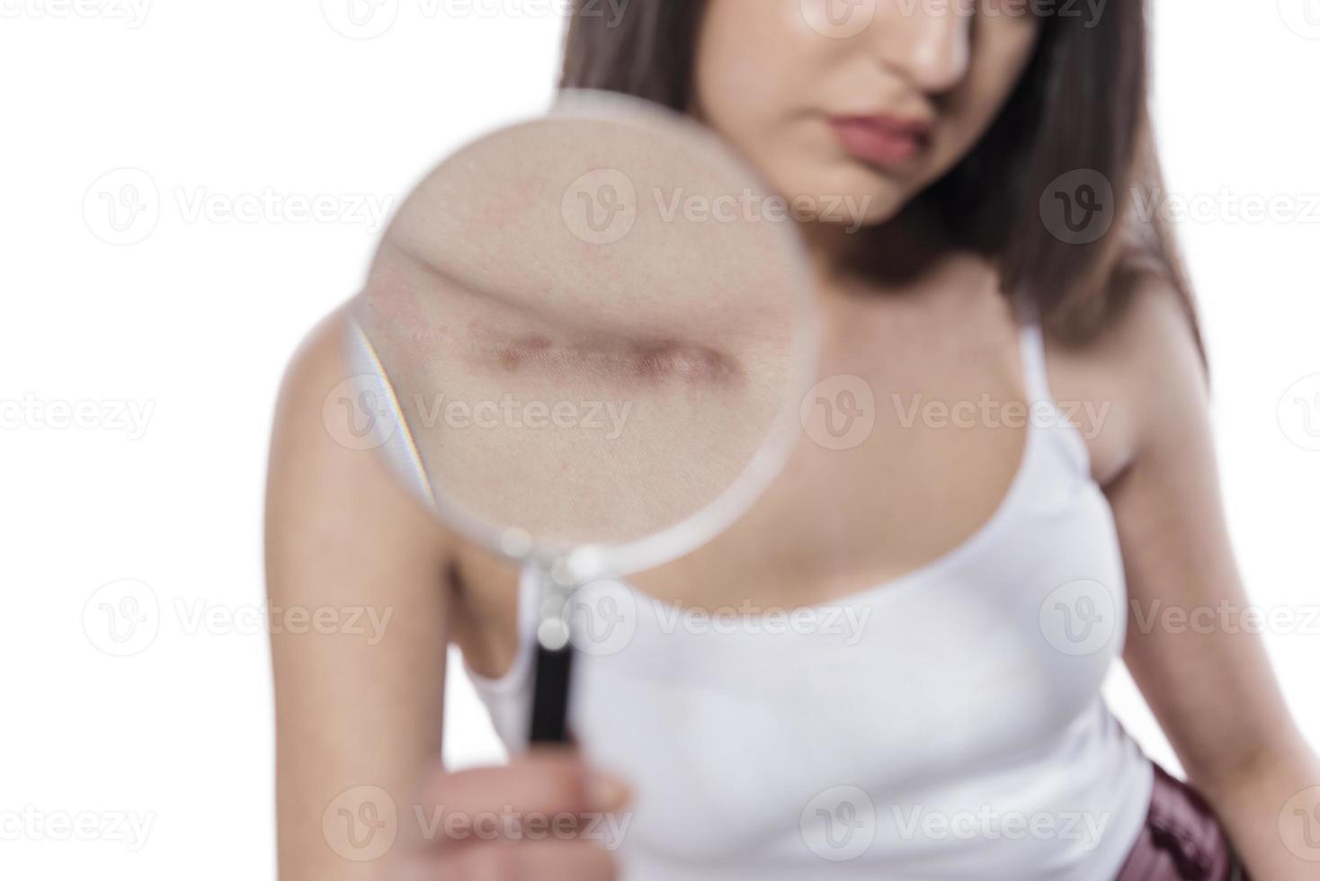 woman  showing surgery scar. Scars removal concept, close up, selective focus photo