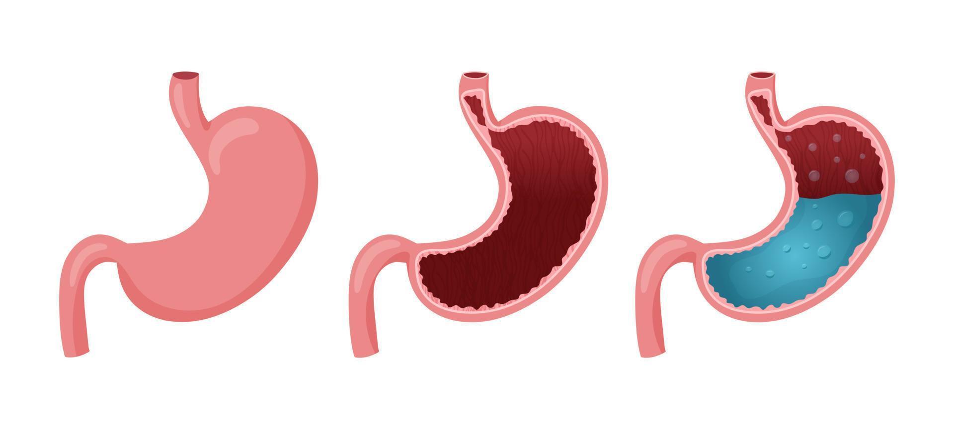 Human stomachs set vector illustration