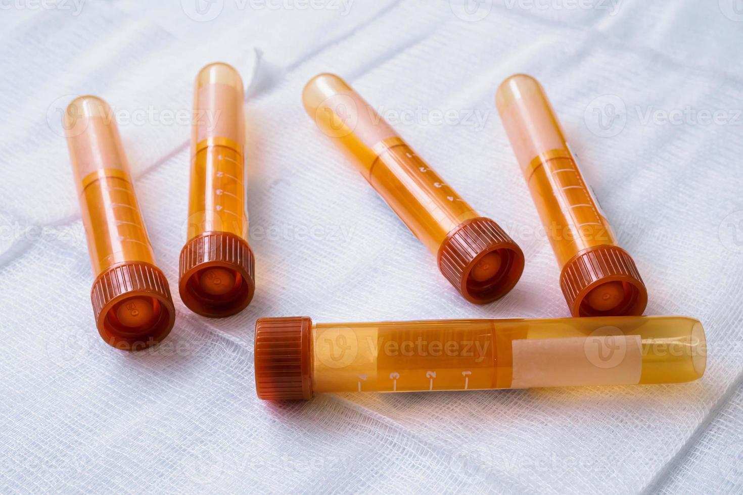 Plastic test tubes with caps for the collection of samples. Blood sampling tubes. photo