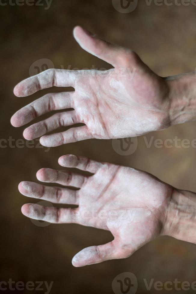 White male palms, Builder photo