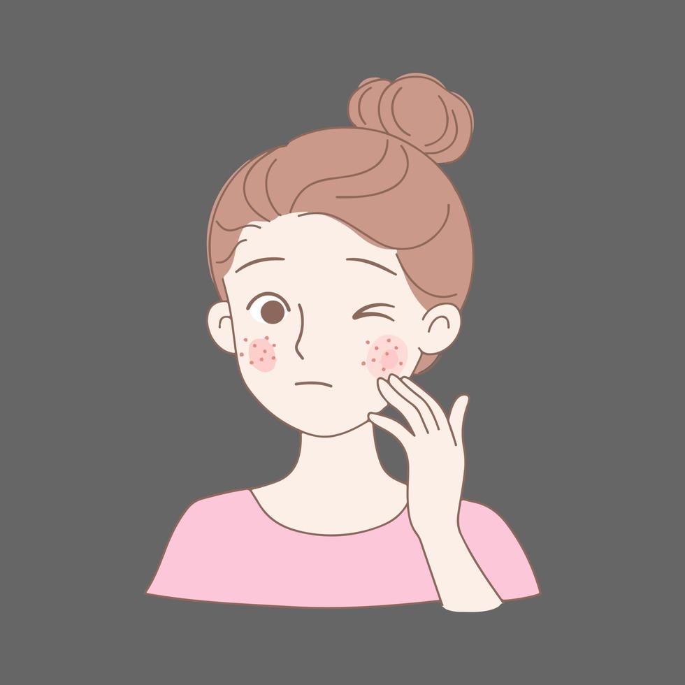 Acne allergies vector inflammation damage scar disease design