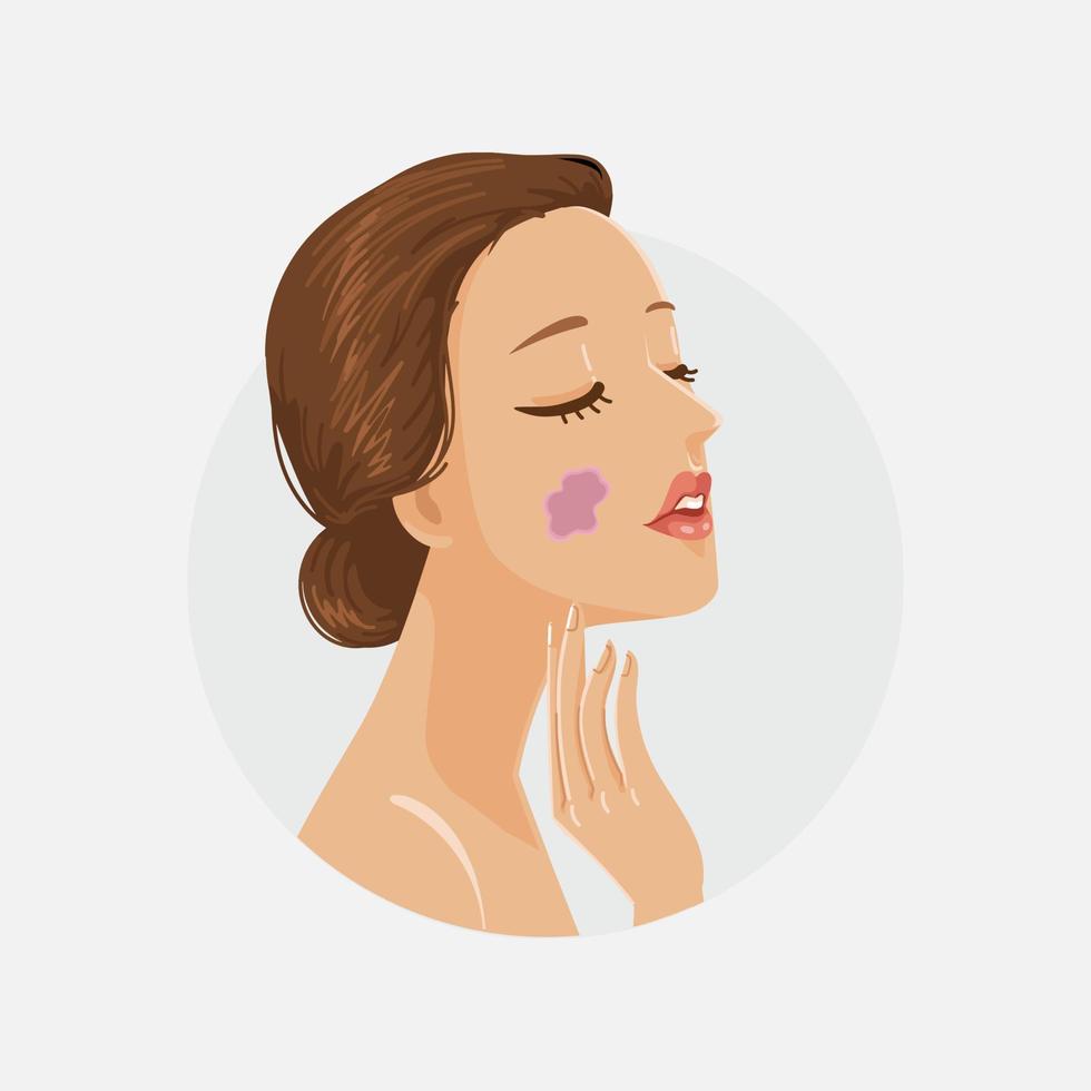 Birthmark stain on the face of the child and adult vector