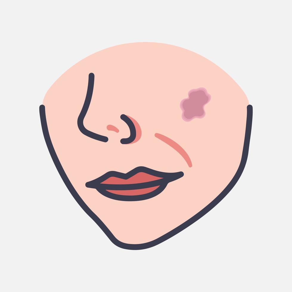 Birthmark stain on the face of the child and adult vector