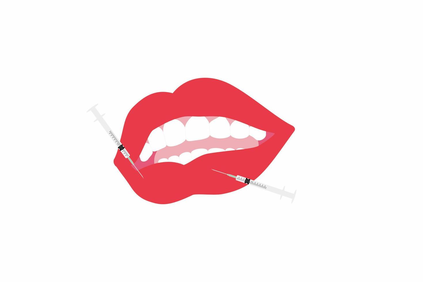 inyecciones de relleno de labios. labios sensuales y jeringas. vector