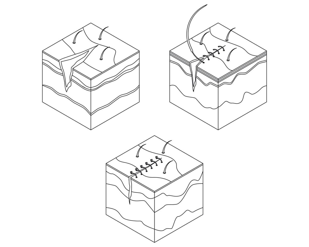 Surgical suture icons set vector outline
