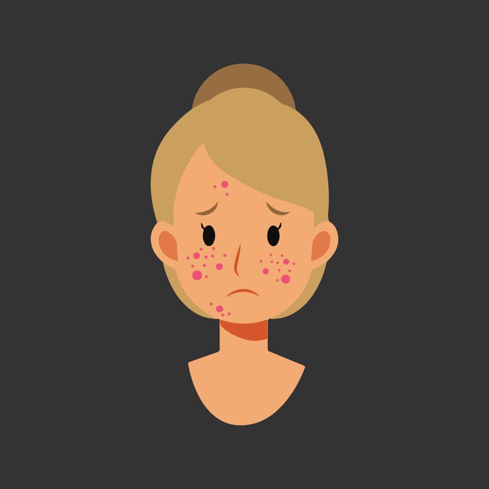 Acne allergies vector inflammation damage scar disease design
